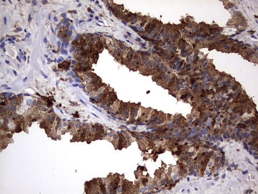LGALS3 / Galectin 3 Antibody (clone OTI1C7)