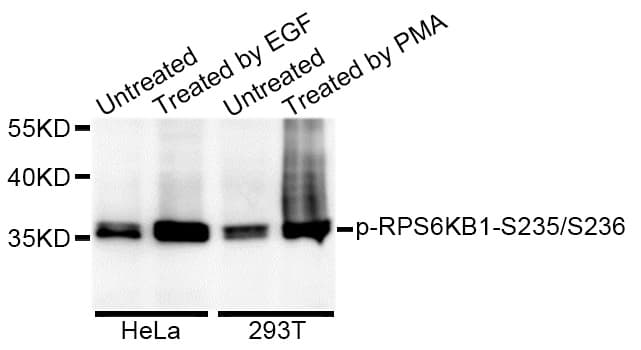Polyclonal Rabbit anti-Human RPS6 / Ribosomal Protein S6 Antibody (phospho-Ser235/236, WB)