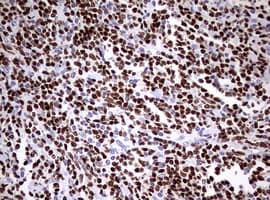 PAX5 Antibody (clone OTI6B6)