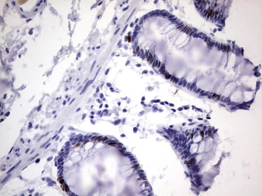 Monoclonal Rat anti-Human MKI67 / Ki67 Antibody (clone OTI3A11, aa1160-1493, IHC)