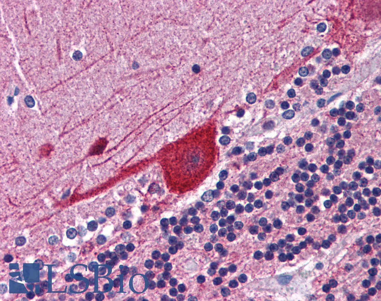 IHC-plus™ FKBP4 / FKBP52 Antibody (aa433-447)