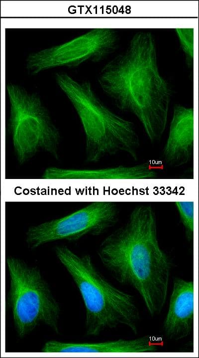 TUBA1A / Tubulin Alpha 1a Antibody (aa227-440)