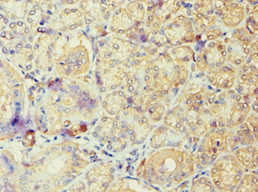 Polyclonal Rabbit anti-Human ARF6 Antibody (aa1-175, IHC, WB)