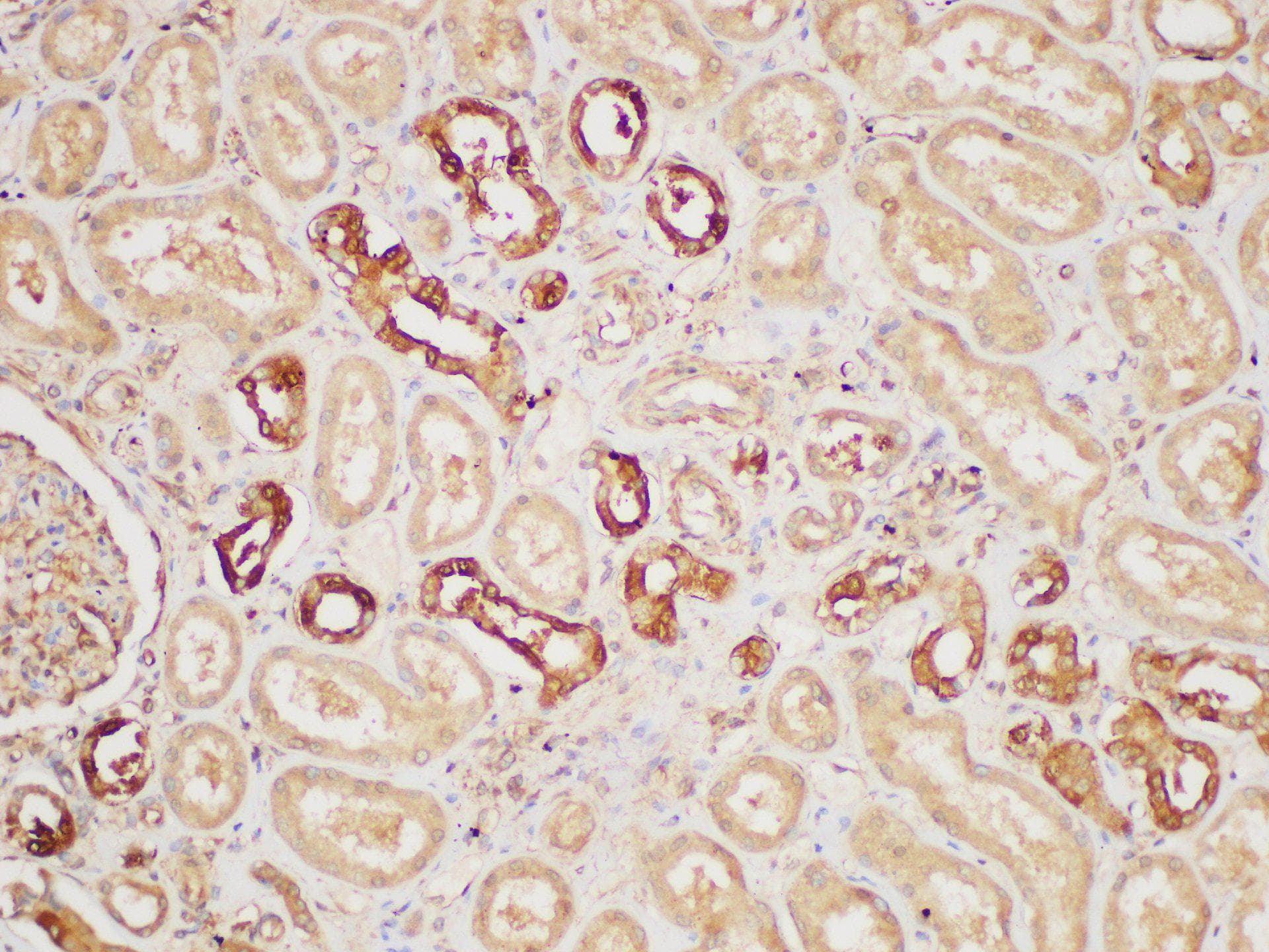Polyclonal Rabbit anti-Human PAIP1 Antibody (IHC)