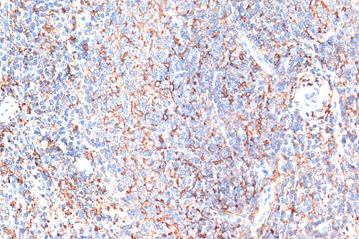 Polyclonal Rabbit anti-Human CD274 / B7-H1 / PD-L1 Antibody (IHC, IF, WB)
