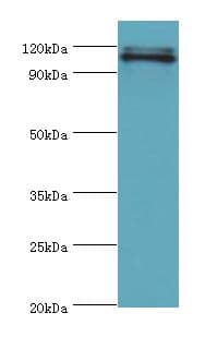 HIP1 Antibody (aa410-690)