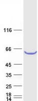 Human TBC1D24 Protein (Recombinant Myc-DDK (Flag))