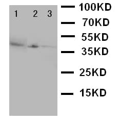 CD1A Antibody (aa158-173)