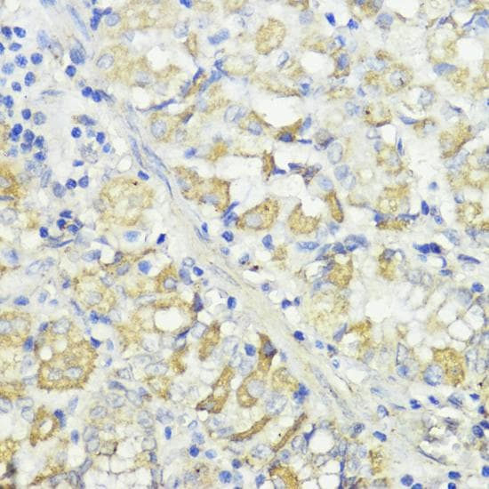 CTSB / Cathepsin B Antibody