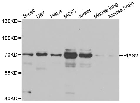 Polyclonal Rabbit anti-Human PIAS2 / PIASX Antibody (IHC, WB)