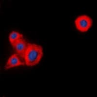p56lck / LCK Antibody (Internal)