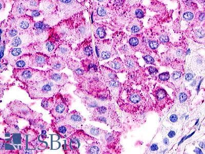 PathPlus™ Polyclonal Rabbit anti-Human GPR21 Antibody (Cytoplasmic Domain, IHC)