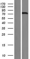 FOXN1 Protein (Over-Expression Lysate Myc-DDK (Flag))
