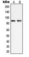 IHC-plus™ Polyclonal Rabbit anti-Human PIP5K1C Antibody (Internal, IHC, WB)
