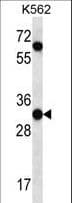 Polyclonal Rabbit anti-Human PI15 Antibody (aa34-63, IHC, WB)