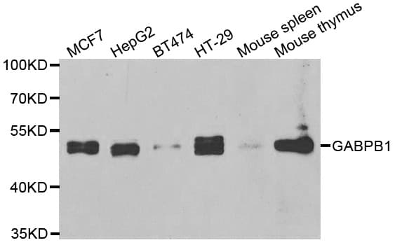 GABPB1 Antibody