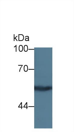 KNG1 / Kininogen / Bradykinin Antibody (APC)