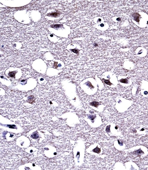 OPRM1 / Mu Opioid Receptor Antibody (aa161-187)