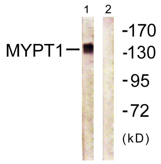 Polyclonal Rabbit anti-Human PPP1R12A / MYPT1 Antibody (aa661-710, IHC, WB)