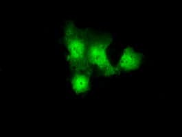 GBE1 Antibody (clone OTI4D9)