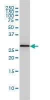Monoclonal Mouse anti-Human PSME2 Antibody (clone 1G4, IHC, WB)