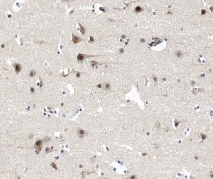Polyclonal Rabbit anti-Human DLG4 / PSD95 Antibody (IHC, WB)