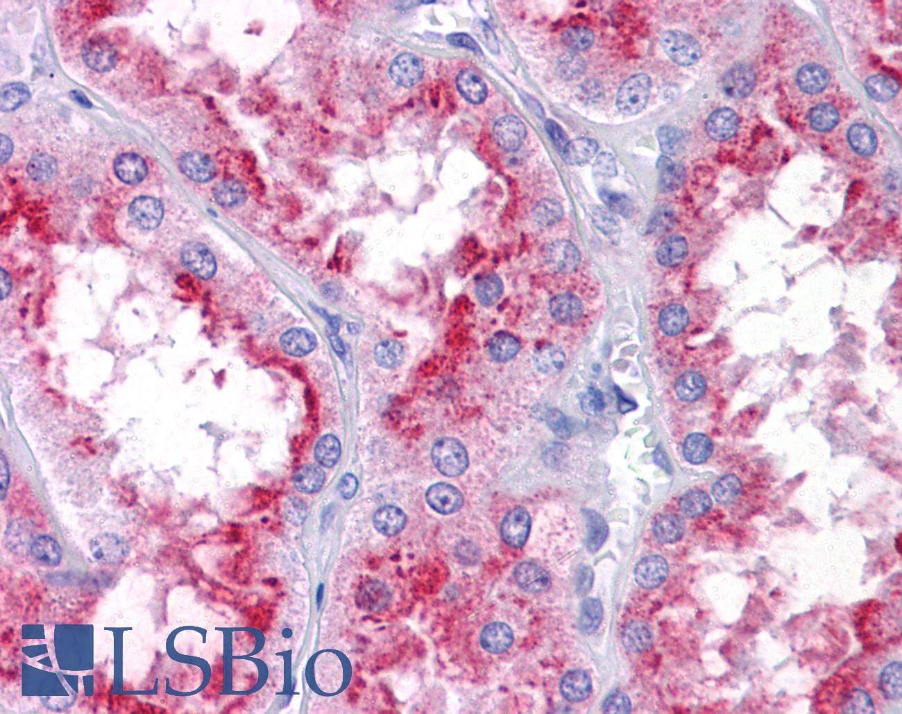 IHC-plus™ PICALM / CALM Antibody