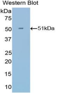 IFNA21 / Interferon Alpha 21 Antibody (aa25-189)