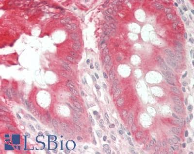 CAST / Calpastatin Antibody (HRP)