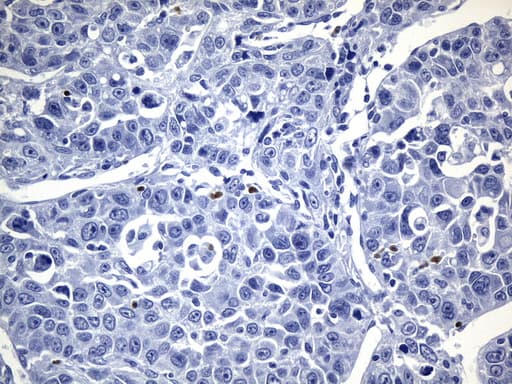 FOXP3 Antibody (clone UMAB248)