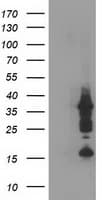 PDLIM2 / SLIM Antibody (clone OTI11A12)