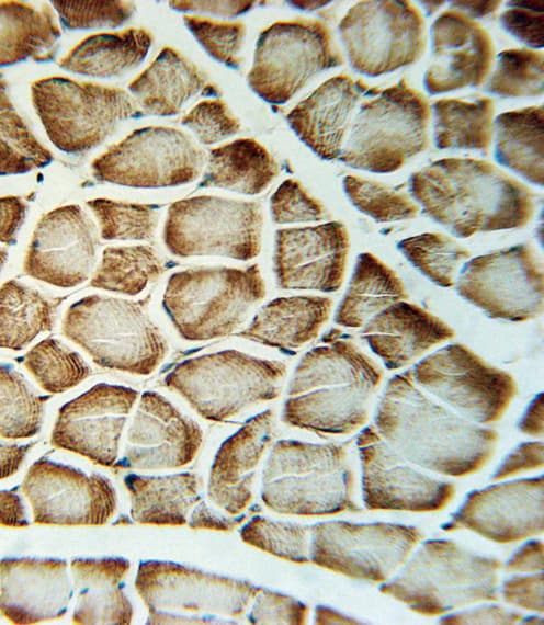Polyclonal Rabbit anti-Human VLDLR Antibody (aa484-510, IHC, WB)