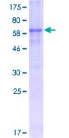 Human MAGEA6 Protein (Recombinant GST)