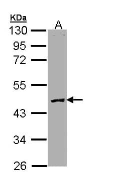 IHC-plus™ PROC / Protein C Antibody (Internal)