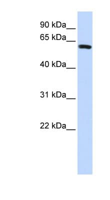 Polyclonal Rabbit anti-Human HSD-1 / SPAG8 Antibody (aa396-445, WB)