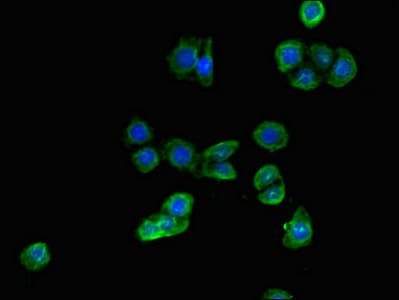 ALDH1A3 Antibody
