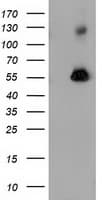 Monoclonal Mouse anti-Human SQSTM1 Antibody (clone OTI4E2, IHC, IF, WB)