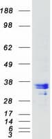Human RNASEH1 Protein (Recombinant Myc-DDK (Flag))