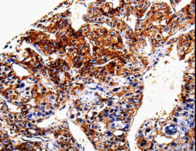 ANXA7 / Annexin VII / SNX Antibody