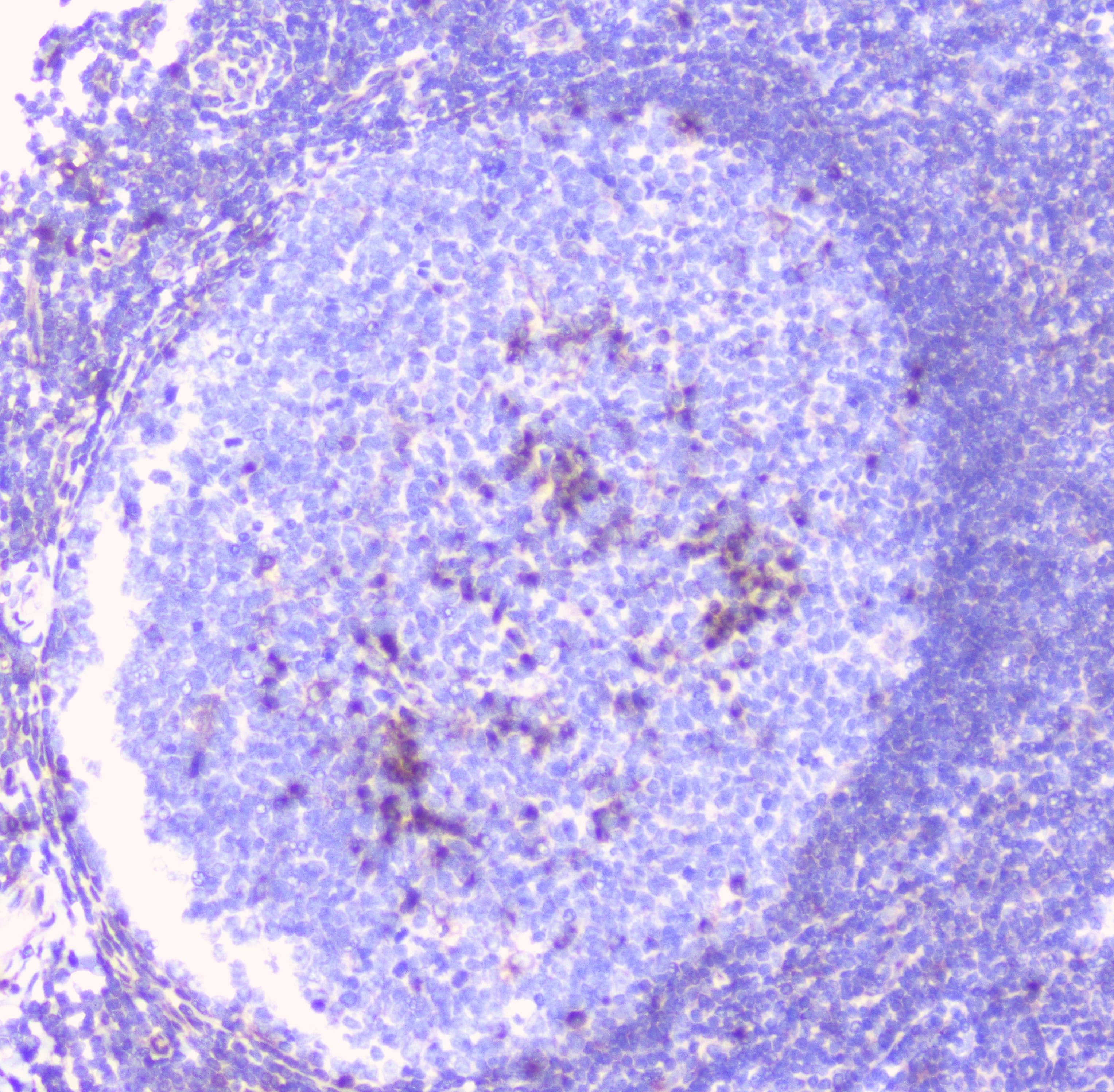 ERGIC-53 / LMAN1 Antibody