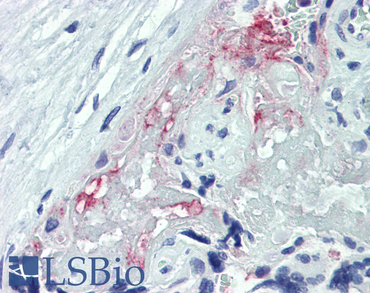 IHC-plus™ ADAM8 Antibody
