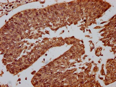 Polyclonal Rabbit anti-Human CENPA / CENP-A Antibody (IHC)