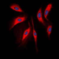 COMT Antibody (Internal)