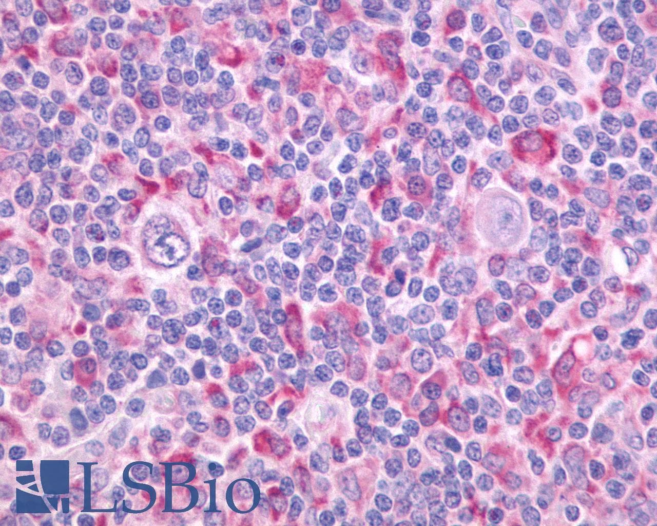 PathPlus™ Polyclonal Rabbit anti-Human ADGRE5 / CD97 Antibody (Cytoplasmic Domain, IHC)