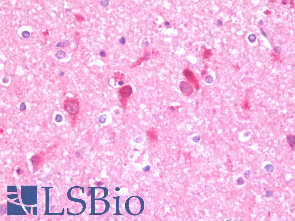 IHC-plus™ Polyclonal Rabbit anti-Human UFD2A / UBE4B Antibody (aa869-1179, IHC, WB)