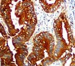Polyclonal Rabbit anti-Human CEA / Carcinoembryonic Antigen Antibody (Ready-to-Use, IHC)