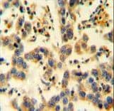 EMC1 Antibody (aa866-894)