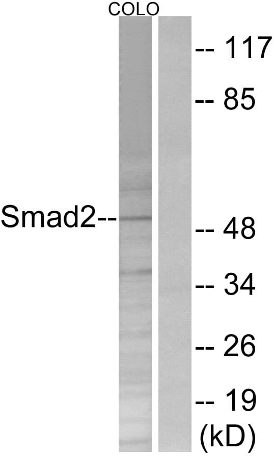 SMAD2 Antibody (aa216-265)