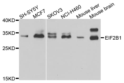 EIF2B1 Antibody