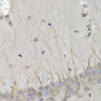 Polyclonal Rabbit anti-Human PSMB10 Antibody (IHC, IF, WB)